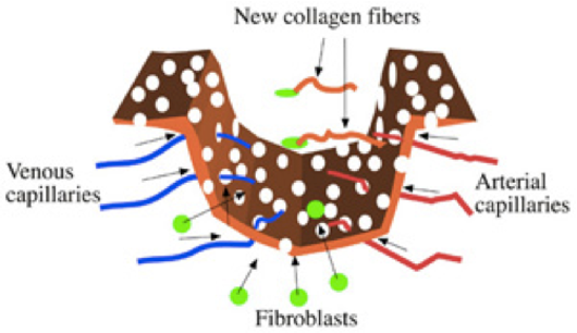 michelle gellis acupuncture physician discusses mironeedling aculift products collagen induction
