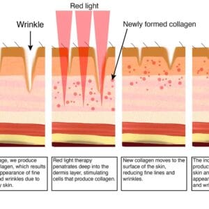 Red light penetrates deep into the dermis to stimulate the cells that produce collagen.